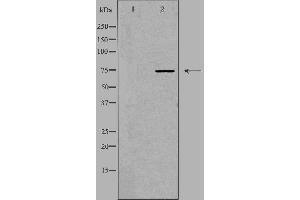 Western blot analysis of extracts from HT-29 cells, using ACS2L antibody. (ACSS1 anticorps  (C-Term))