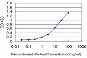 Detection limit for recombinant GST tagged IRAK2 is approximately 0. (IRAK2 anticorps  (AA 111-210))