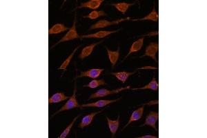 Immunofluorescence analysis of L929 cells using  antibody (ABIN7265696) at dilution of 1:100.