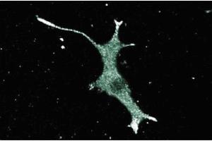 Immunoflourescence staining of PC12 cells (rat neuroblastoma, ATCC CRL 1721).