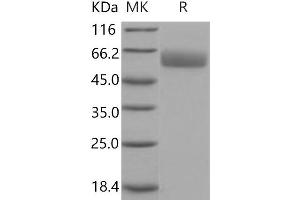 Western Blotting (WB) image for Serpin Family A Member 7 (SERPINA7) protein (His tag) (ABIN7197956)