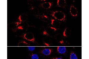 Immunofluorescence analysis of HeLa cells using USO1 Polyclonal Antibody at dilution of 1:200 (60x lens). (USO1 anticorps)