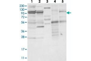 Western blot analysis of Lane 1: RT-4, Lane 2: U-251 MG, Lane 3: Human Plasma, Lane 4: Liver, Lane 5: Tonsil with TBC1D5 polyclonal antibody . (TBC1D5 anticorps)