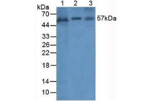 Rabbit Detection antibody from the kit in WB with Positive Control: Sample Lane1: Human Cartilage Tissue; Lane2: Human A549 Cells; Lane3: Human Liver Tissue. (Angiopoietin 1 Kit CLIA)