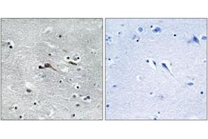 Immunohistochemistry (IHC) image for anti-Cytokine-Like 1 (CYTL1) (AA 61-110) antibody (ABIN6766393) (CYTL1 anticorps  (AA 61-110))