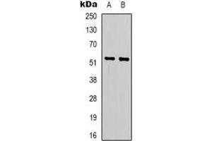 Western blot analysis of LIPI expression in Jurkat (A), HepG2 (B) whole cell lysates. (Lipase I anticorps)