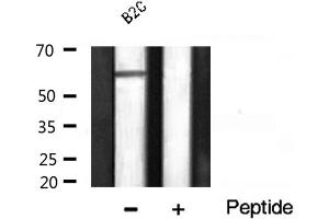 Western blot analysis of Akt1 phosphorylation expression in B2C whole cell lysates,The lane on the right is treated with the antigen-specific peptide.