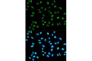 Immunofluorescence analysis of HeLa cells using HNRNPA2B1 antibody (ABIN5970508). (HNRNPA2B1 anticorps)