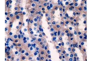 DAB staining on IHC-P; Samples: Rat Kidney Tissue (Ladinin 1 anticorps  (AA 1-140))