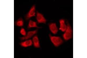 ABIN6276229 staining COLO205 by IF/ICC. (TAS2R8 anticorps  (Internal Region))