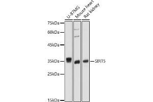 Western blot analysis of extracts of various cell lines, using SIRT5 antibody (ABIN6129331, ABIN6147798, ABIN6147799 and ABIN6221468) at 1:1000 dilution. (SIRT5 anticorps  (AA 1-310))