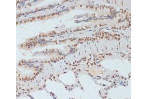 Immunohistochemistry of paraffin-embedded Rat lung using Phospho-p53(S33) Polyclonal Antibody at dilution of 1:100 (40x lens).
