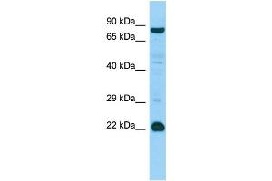 WB Suggested Anti-MED22 Antibody Titration: 1. (MED22 anticorps  (Middle Region))