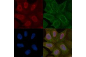 SENP2 Mouse Monoclonal Antibody staining Hela cells by IF/ICC. (SENP2 anticorps)