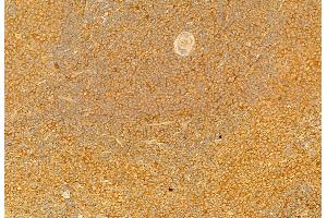 ABIN6264594 and ABIN6279749 at 1/100 staining Rat spleen tissue by IHC-P. (RAB9B anticorps  (Internal Region))