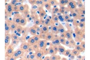 Detection of TAN1 in Mouse Liver Tissue using Polyclonal Antibody to Translocation Associated Notch Homolog 1 (TAN1)