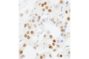 Immunohistochemistry (IHC) image for anti-General Transcription Factor IIIC, Polypeptide 5 (GTF3C5) (AA 469-519) antibody (ABIN7448588)