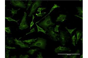 Immunofluorescence of monoclonal antibody to TAP1 on HeLa cell. (TAP1 anticorps  (AA 241-350))