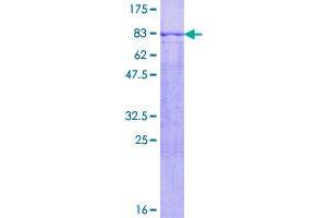 Image no. 1 for Patatin-Like phospholipase Domain Containing 2 (PNPLA2) (AA 1-504) protein (GST tag) (ABIN1315583)