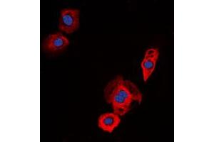 Immunofluorescent analysis of EGFR staining in Jurkat cells. (EGFR anticorps  (C-Term))