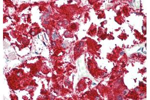 Rabbit Anti-RAPGEF2 antibody  Formalin Fixed Paraffin Embedded Tissue: Human Adrenal Primary antibody Concentration: 1:100 Secondary Antibody: Donkey anti-Rabbit-Cy3 Secondary Antibody Concentration: 1:200 Magnification: 20x Exposure Time: 0.