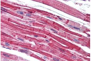 anti-Lysophosphatidic Acid Receptor 3 (LPAR3) (AA 1-12) antibody