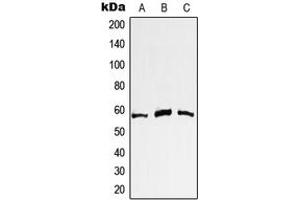 Western blot analysis of c-Myc expression in A431 (A), Jurkat (B), HeLa (C) whole cell lysates. (c-MYC anticorps  (N-Term))