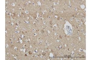 Immunoperoxidase of monoclonal antibody to SH3GL2 on formalin-fixed paraffin-embedded human cerebral cortex.