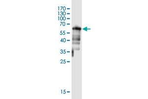 Western Blot detection against Immunogen (61. (DTWD1 anticorps  (AA 1-304))