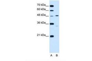 Image no. 2 for anti-Carbohydrate (Keratan Sulfate Gal-6) Sulfotransferase 1 (CHST1) (AA 74-123) antibody (ABIN320945) (CHST1 anticorps  (AA 74-123))