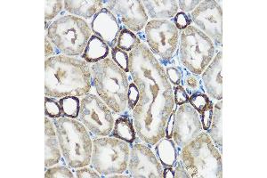 Immunohistochemistry of paraffin-embedded rat kidney using IP6K1 Rabbit pAb (ABIN6131922, ABIN6142500, ABIN6142501 and ABIN6215821) at dilution of 1:100 (40x lens). (IP6K1 anticorps  (AA 1-220))