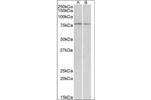 <strong>Western blot analysis:</strong> DAG1 antibody staining of Mouse and Rat Skeletal Muscle lysate at 0. (Dystroglycan anticorps  (Internal Region))