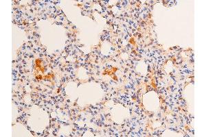 ABIN6267289 at 1/100 staining rat lung cancer tissue sections by IHC-P.