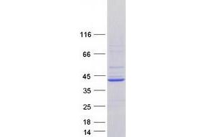 Validation with Western Blot