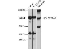 Western blot analysis of extracts of various cell lines, using RP/RP Rabbit mAb (ABIN7269915) at 1:1000 dilution. (RPA1 anticorps)