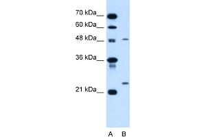 WB Suggested Anti-SMPD2 Antibody Titration:  1. (SMPD2 anticorps  (N-Term))