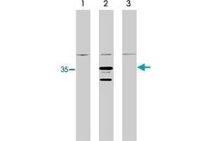Western blot analysis using RIT1 monoclonal antibody, clone 14G7  on control 293 cells (lane 1), 293 cells expressing HA-tagged RIT1 protein (lane 2) and 293 cells expressing HA-tagged RIT2 protein (3). (RIT1 anticorps)