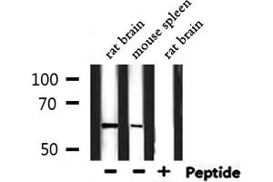 Western blot analysis of extracts from rat brain, mouse spleen, using Phospho-PDK1 (Ser241) Antibody.