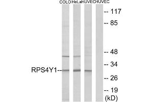 Western blot analysis of extracts from COLO cells, HeLa cells and HUVEC cells, using RPS4Y1 antibody. (RPS4Y1 anticorps  (C-Term))