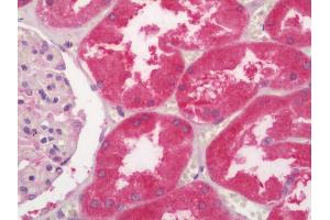 Human Kidney: Formalin-Fixed, Paraffin-Embedded (FFPE)