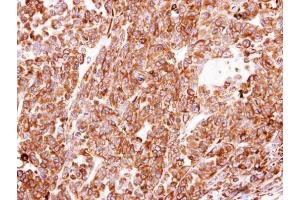 IHC-P Image Immunohistochemical analysis of paraffin-embedded H520 xenograft, using PDI, antibody at 1:100 dilution. (P4HB anticorps)