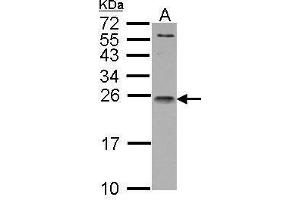 WB Image IL1 Receptor antagonist antibody detects IL1RN protein by Western blot analysis. (IL1RN anticorps)