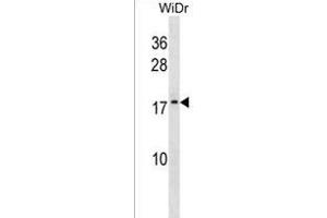ATP5L2 Antibody (N-term) (ABIN1538885 and ABIN2850205) western blot analysis in WiDr cell line lysates (35 μg/lane).