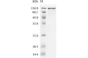 (Tris-Glycine gel) Discontinuous SDS-PAGE (reduced) with 5 % enrichment gel and 15 % separation gel.