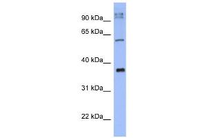 WB Suggested Anti-KCTD4 Antibody Titration:  0. (KCTD4 anticorps  (N-Term))