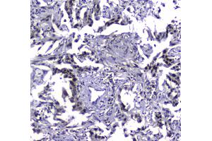 IHC analysis of MDC1 using anti-MDC1 antibody .