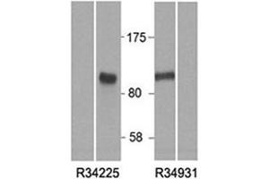 Western blot of HEK293 lysate overexpressing human HIC1 tested with HIC1 antibody at (0. (HIC1 anticorps)