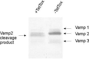dilution: 1 : 1000, sample: crude synaptosomal fraction of rat brain (P2) (VAMP1, 2, 3 (AA 1-81) anticorps)