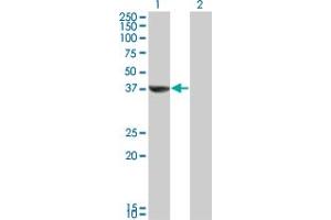 Western Blot analysis of TAF5L expression in transfected 293T cell line by TAF5L monoclonal antibody (M01A), clone 1C5. (TAF5L anticorps  (AA 1-117))