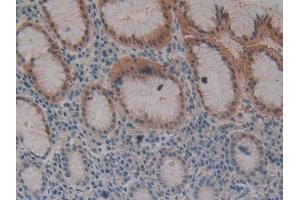 DAB staining on IHC-P; Samples: Human Stomach Tissue (Fibrillin 3 anticorps  (AA 403-667))